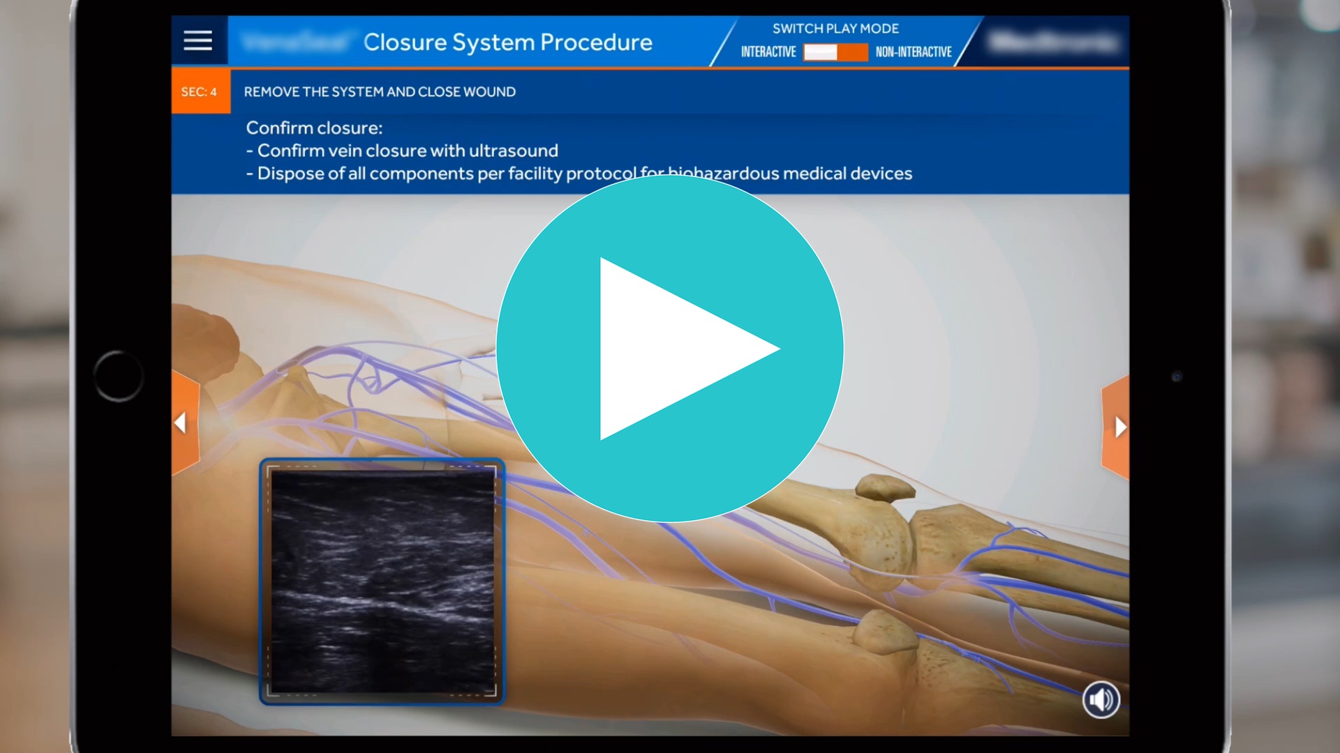 Procedure Simulation 1