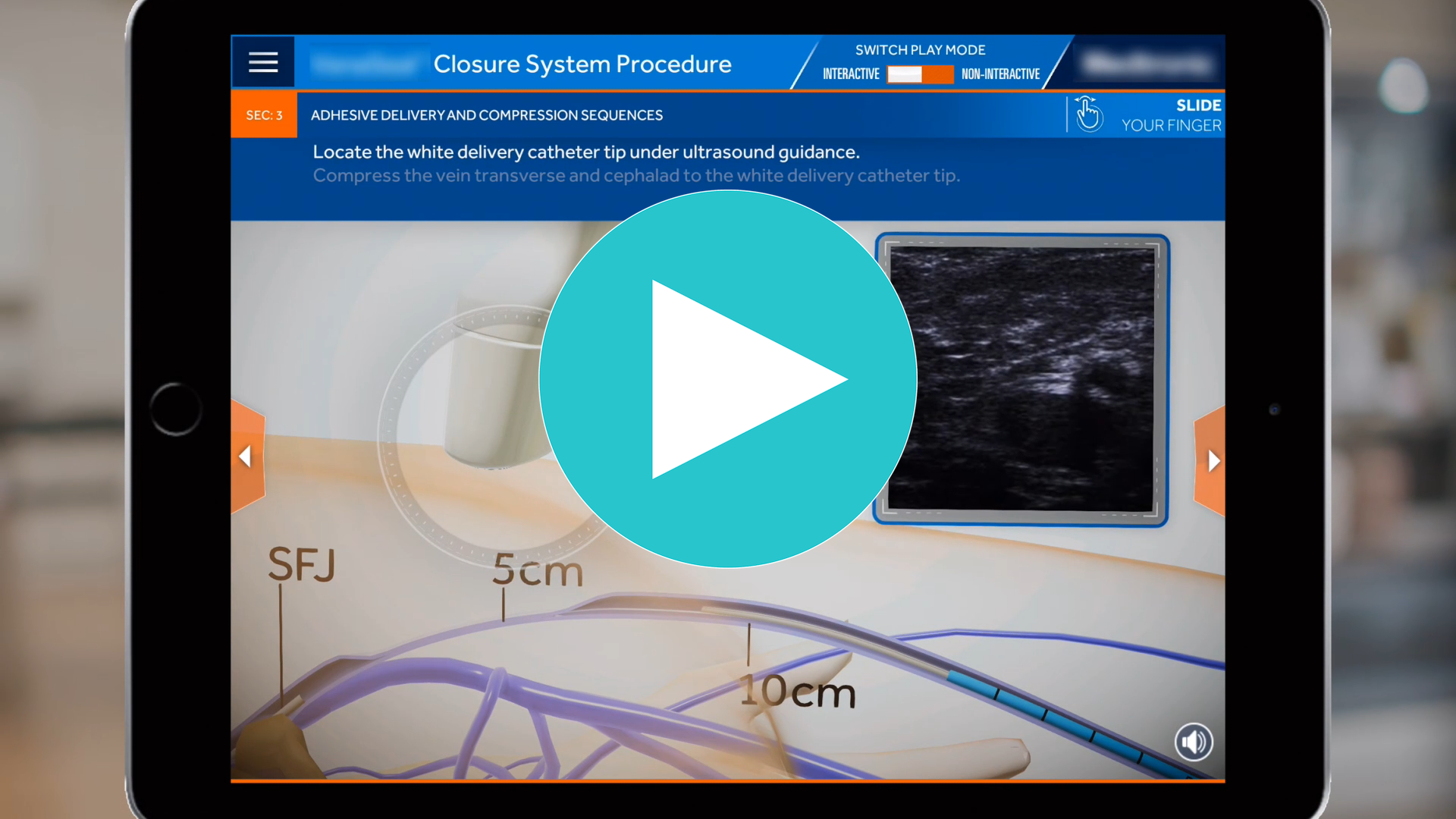 Procedure Simulation 2